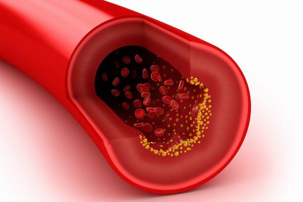 کلسترول یعنی چه؟