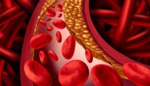 Cholesterol lowering-01