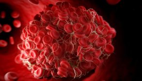 Herbal-Blood-Thickness-Treatment-02