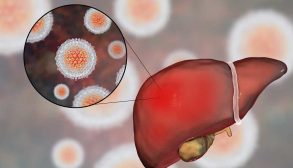 treatment-hepatitis-01